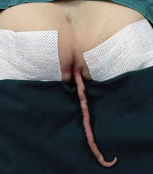 Cacat Sejak Lahir Anak Laki-laki ini  Dijuluki 'Monyet Kecil'